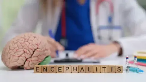 What Foods Should You Avoid if You Have Encephalitis?